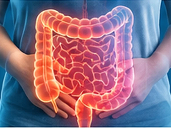 IBS Ayurvedic treatment